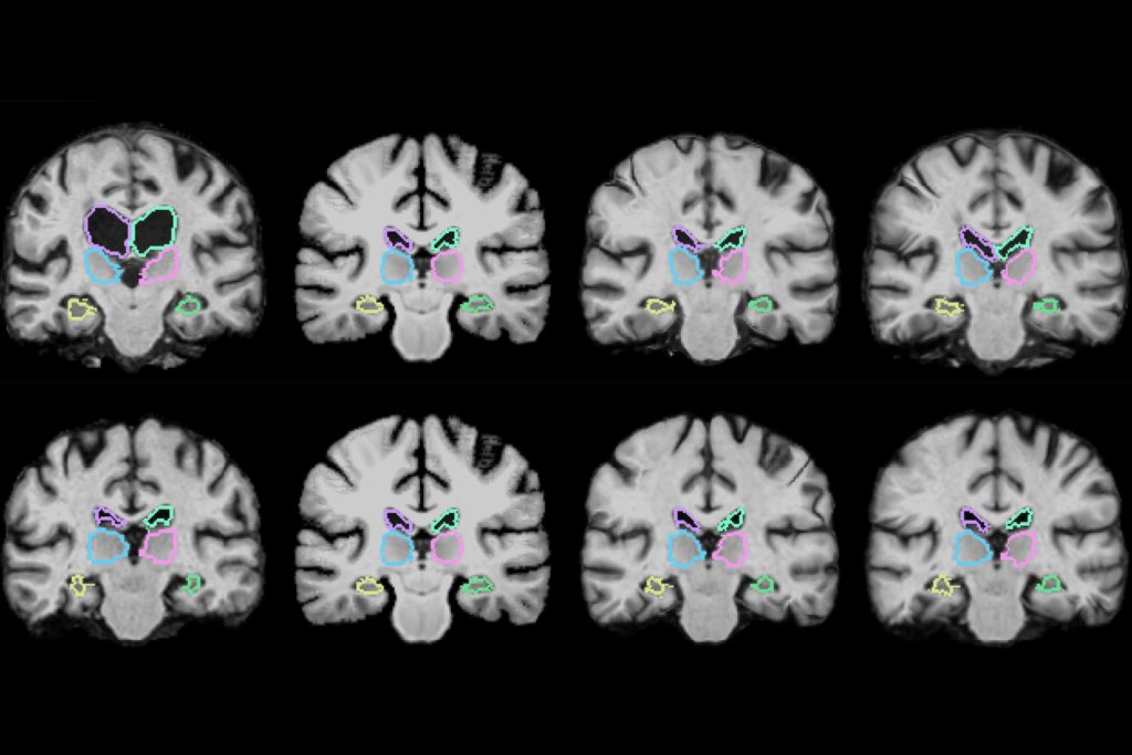 DICOM viewer free online
