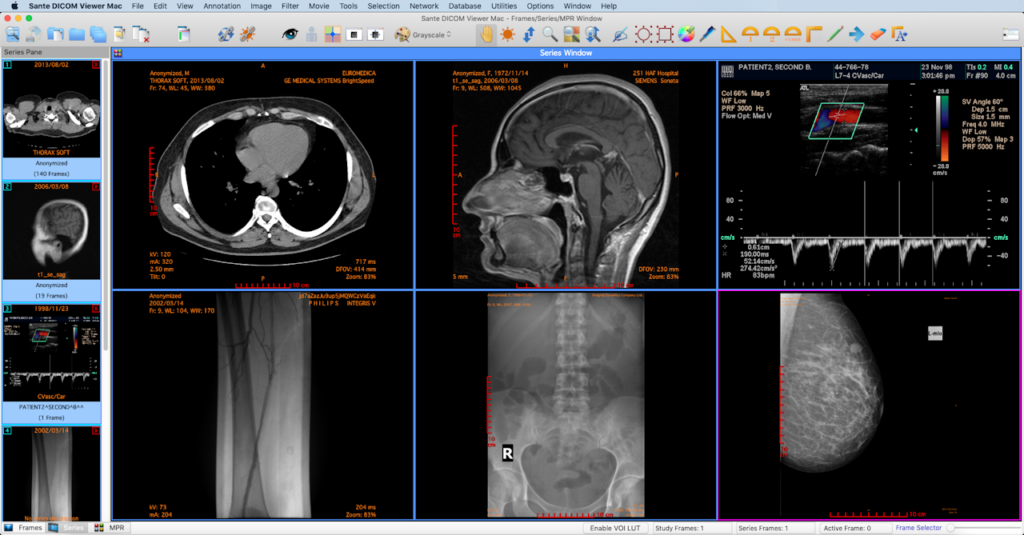 DICOM Reader Online