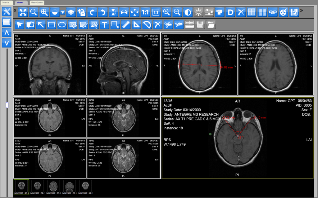 DICOM Reader Online