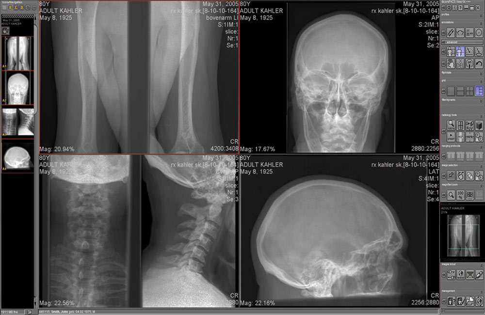 PACS medical imaging software